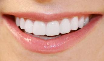 [n] Nha khoa bọc răng sứ đẹp uy tín chất lượng tại TP. HCM