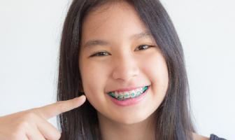 [n] Nha khoa niềng răng uy tín chất lượng tại tỉnh Phú Thọ