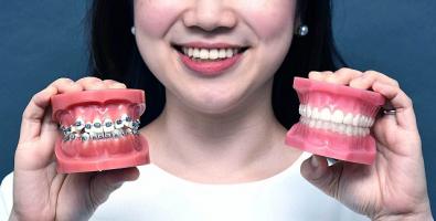 [n] Nha khoa niềng răng uy tín chất lượng tại quận Tân Bình, TP. HCM