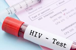 [n] Bệnh viện xét nghiệm HIV uy tín hàng đầu tại Hà Nội