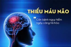 [n] Bệnh viện khám và điều trị thiếu máu não uy tín hiệu quả tại Hà Nội