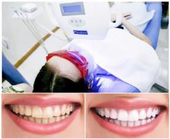 Phòng khám nha khoa tẩy trắng răng uy tín tại quận Hai Bà Trưng, Hà Nội