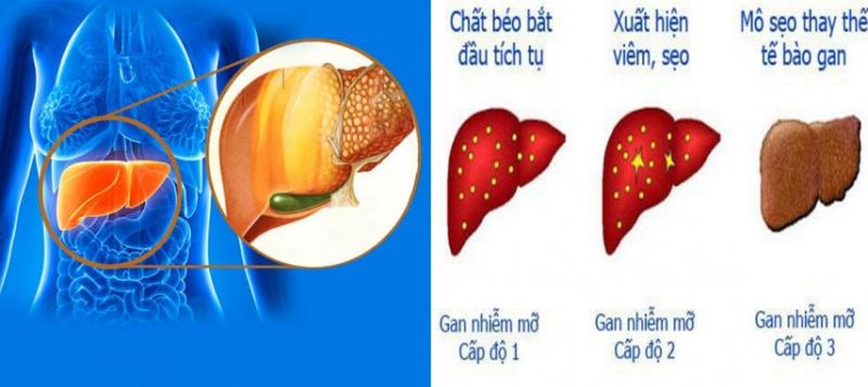 Bệnh viện Chợ Rẫy