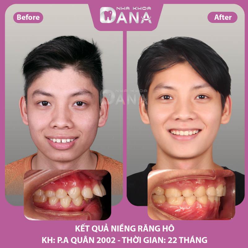 Dana Dental - Nha Khoa Đà Nẵng