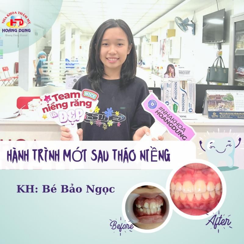 Nha khoa thẩm mỹ Hoàng Dung