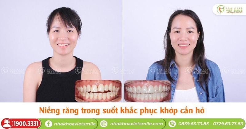 Nha khoa Việt Smile