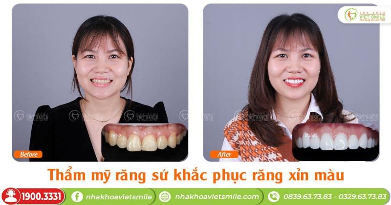 Nha khoa Việt Smile