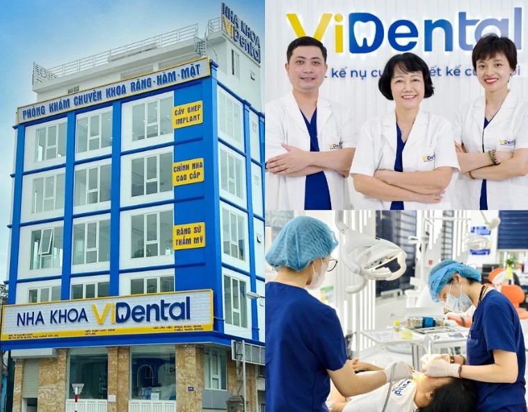 Nếu bạn đang tìm kiếm cơ sở trám răng an toàn uy tín tại Hà Nội, không thể bỏ qua nha khoa ViDental.
